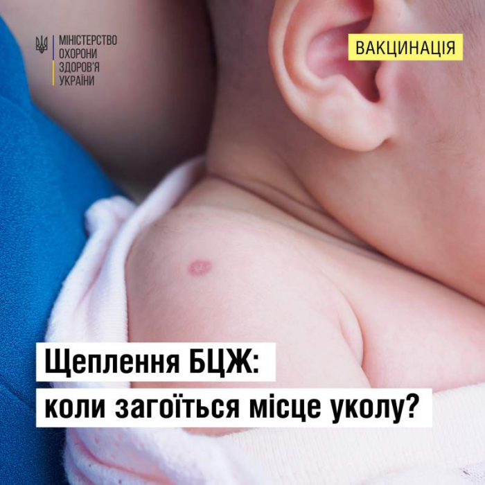 Щеплення БЦЖ: Коли загоїться місце уколу?